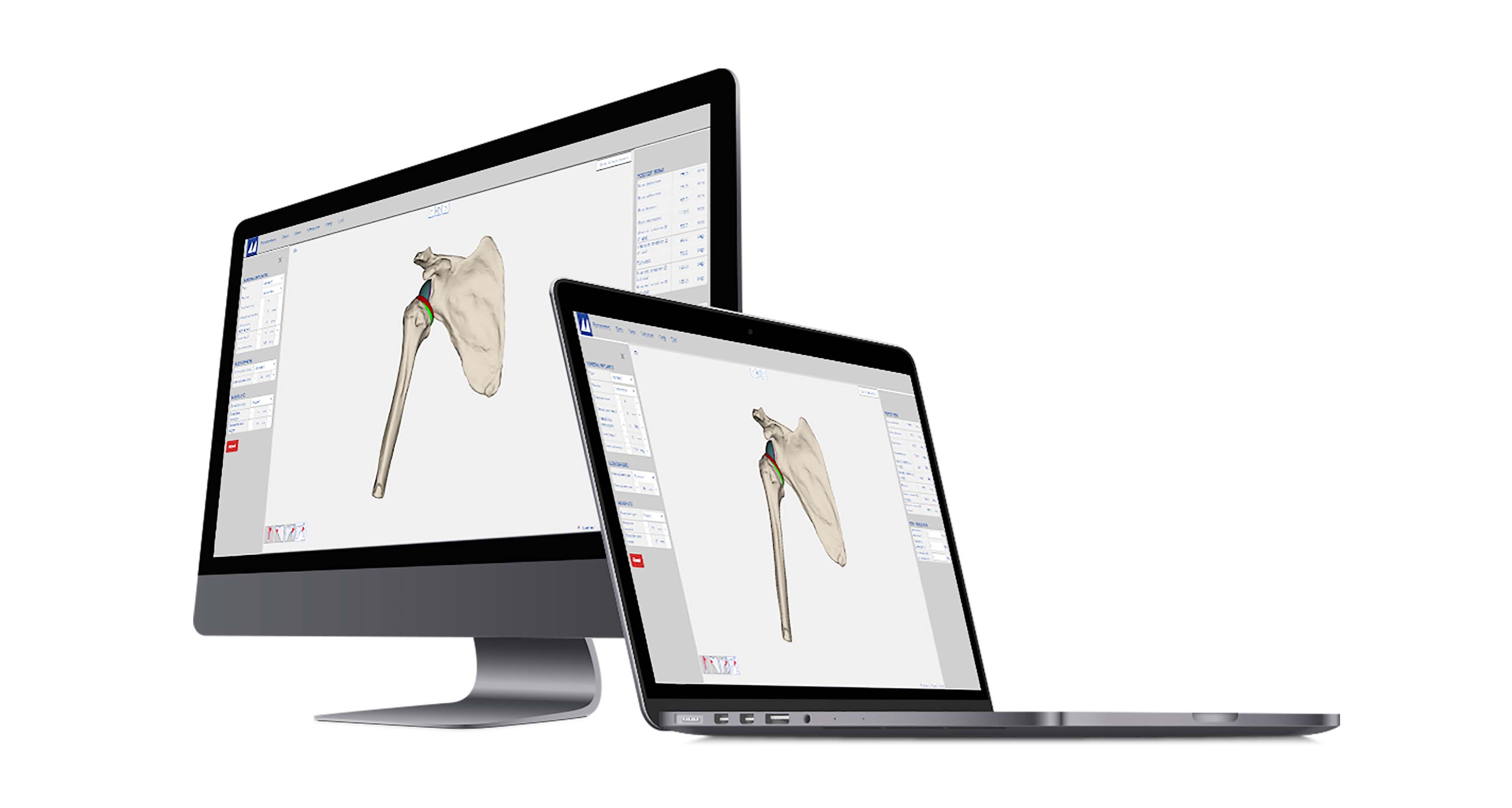 3D PLANNING TOOL