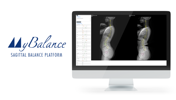MYBALANCE